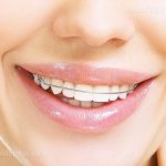 چه مواردی را برای عکس بینی برای عمل جراحی بینی (رینوپلاستی) باید رعایت کرد؟